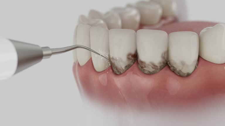Trusted Teeth Whitening service in Noble, OK - Dentist Open Now